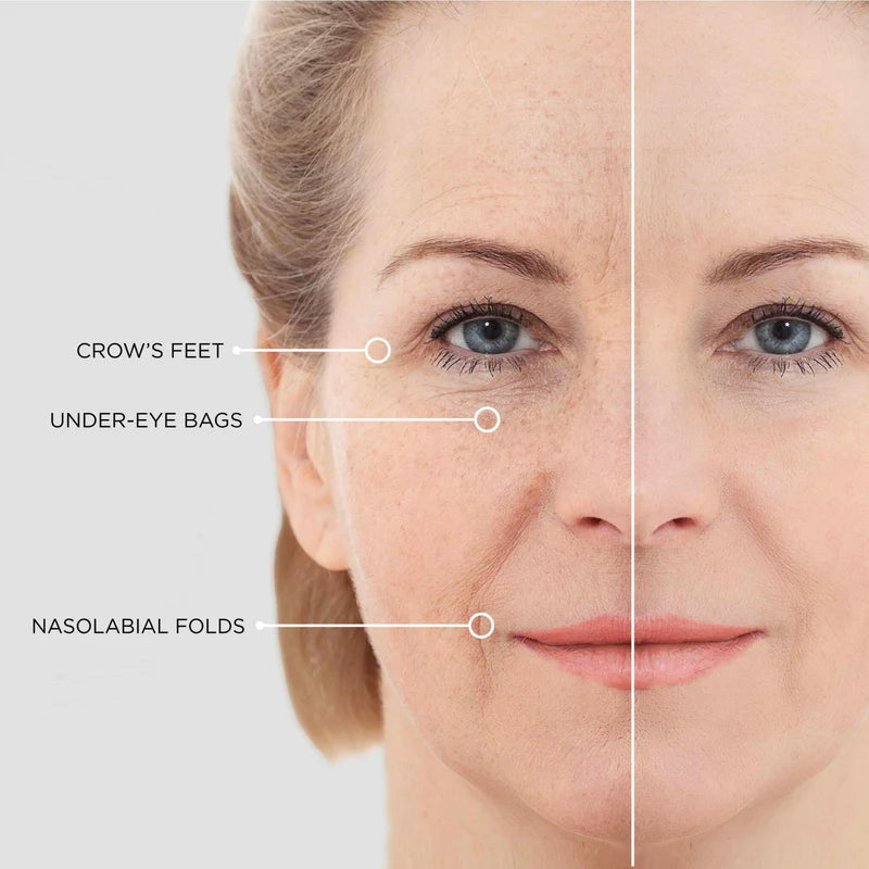 MicroLift Firming Patches