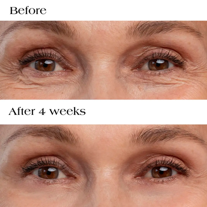 MicroLift Firming Patches